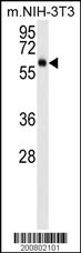 WB - AKT3 Antibody AM1849B